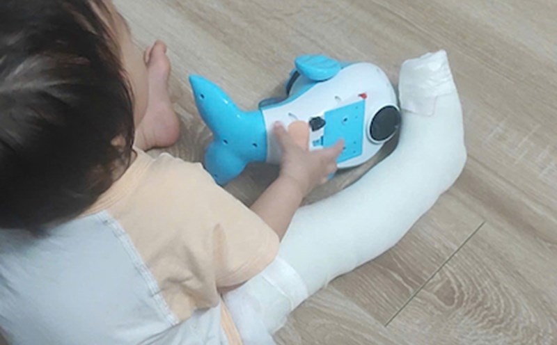 Phụ huynh cho biết, cháu bé 13 tháng bị gãy xương chân phải, phải bó bột, sau khi đón con ở trường hôm 13.8. Ảnh: Gia đình cung cấp