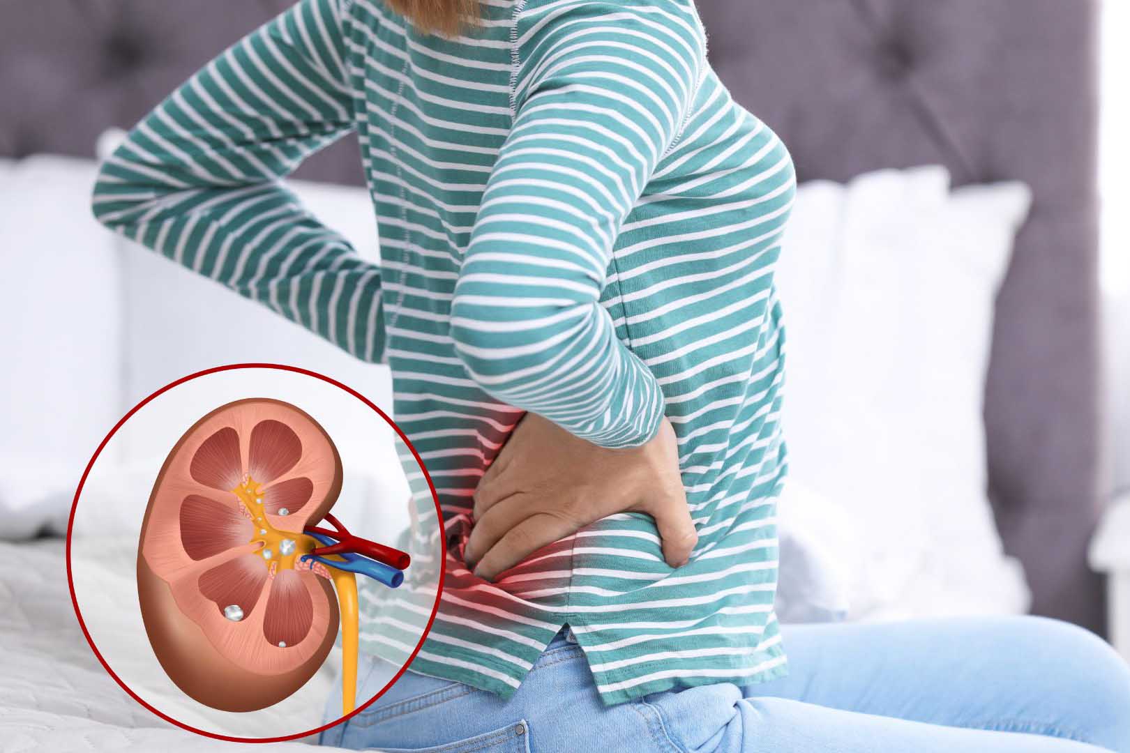 Những việc tưởng “vô hại” nhưng âm thầm phá hủy thận của bạn