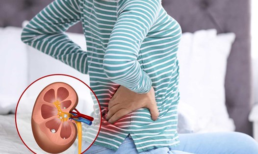 Những việc tưởng “vô hại” nhưng âm thầm phá hủy thận của bạn