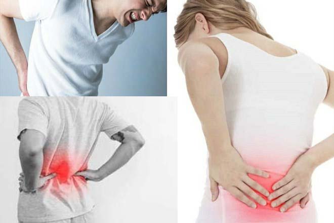 Lower back pain can range from mild to severe, affecting quality of life. Graphics: Ngoc Thuy