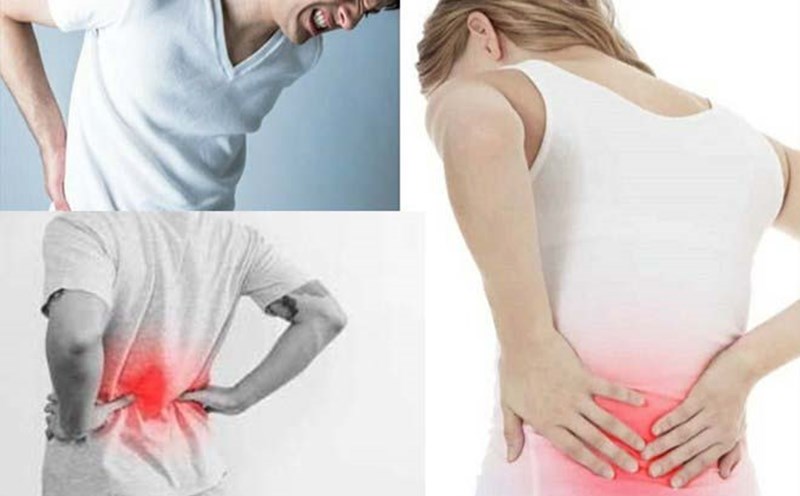 Lower back pain can range from mild to severe, affecting quality of life. Graphics: Ngoc Thuy