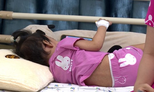 Trẻ mắc bệnh sởi khi chưa kịp tiêm vaccine sởi. Ảnh: NGUYỄN LY