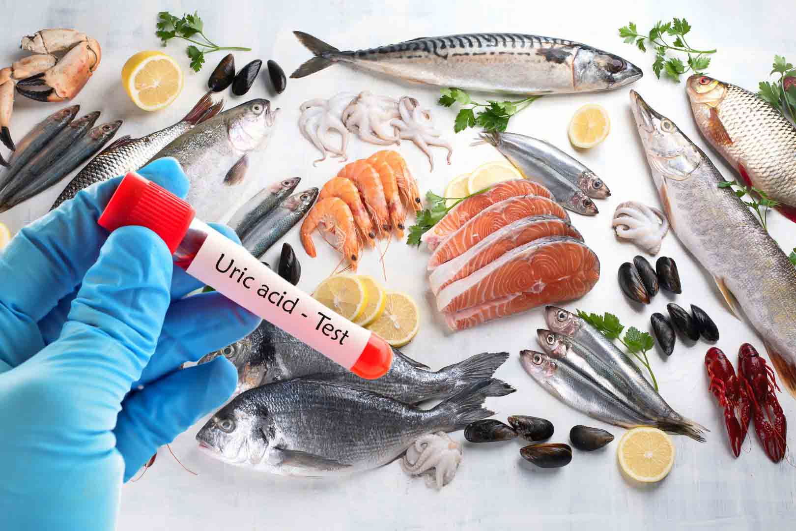 Ba loại cá giàu purine, người axit uric cao nên tránh xa