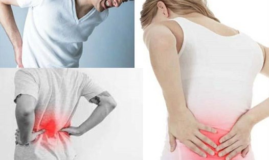 Hút thuốc làm trầm trọng thêm tình trạng đau lưng dưới. Đồ họa: Ngọc Thùy