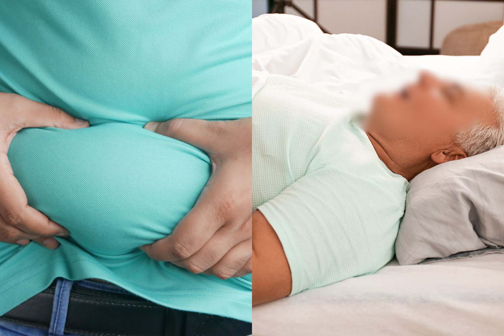 How is obesity related to snoring?