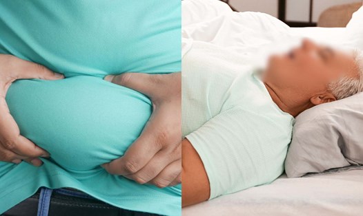 Béo phì liên quan thế nào đến việc ngủ ngáy?