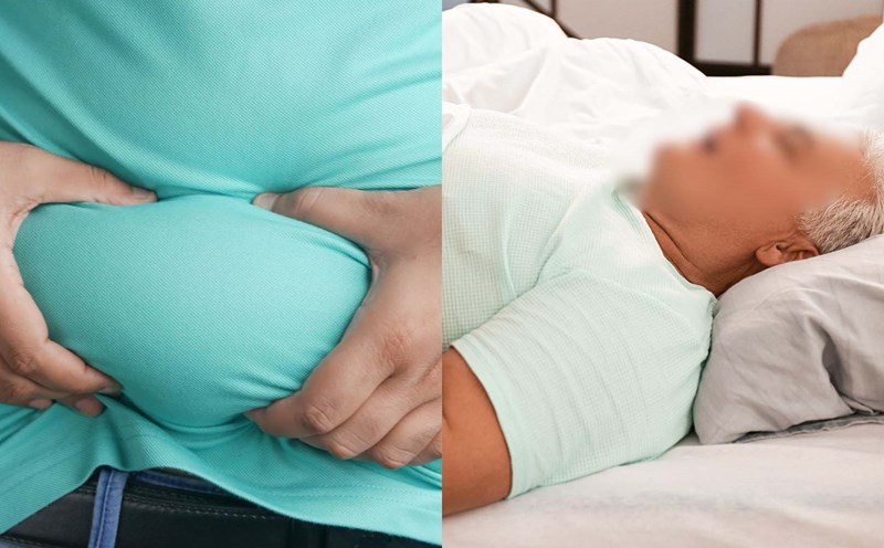 How is obesity related to snoring?
