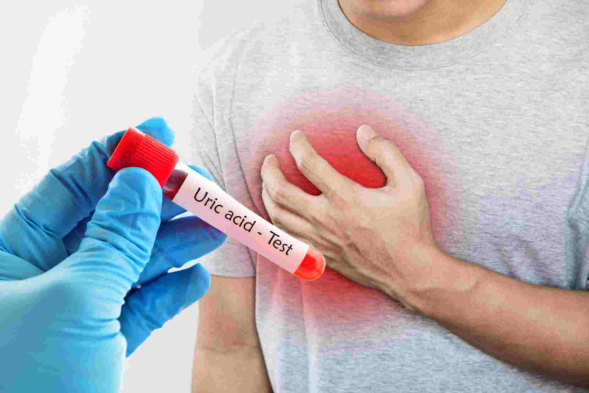 How does high uric acid level affect cardiovascular disease?