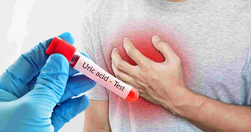 Nồng độ axit uric cao ảnh hưởng ra sao tới bệnh tim mạch?