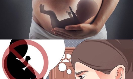 Số ca mang thai ở tuổi vị thành niên có xu hướng giảm. Đồ họa: Thanh Bình.