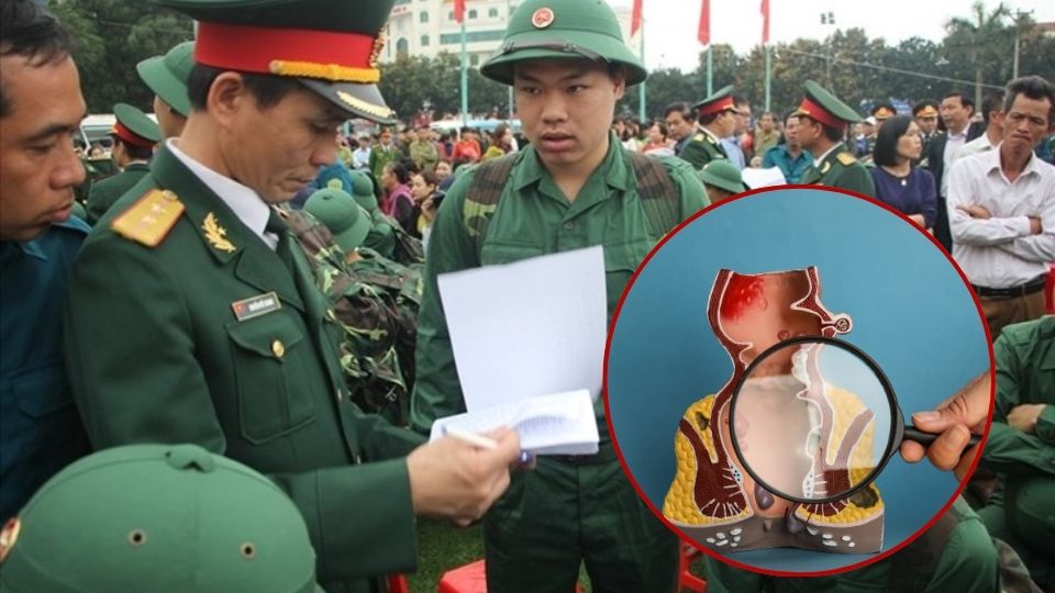 Are hemorrhoids exempt from military service?