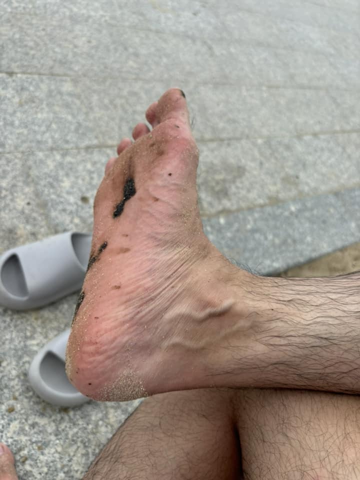 Tourists jogging stepped in clumps of oil on the beach in Nha Trang. Photo: Tony Nguyen