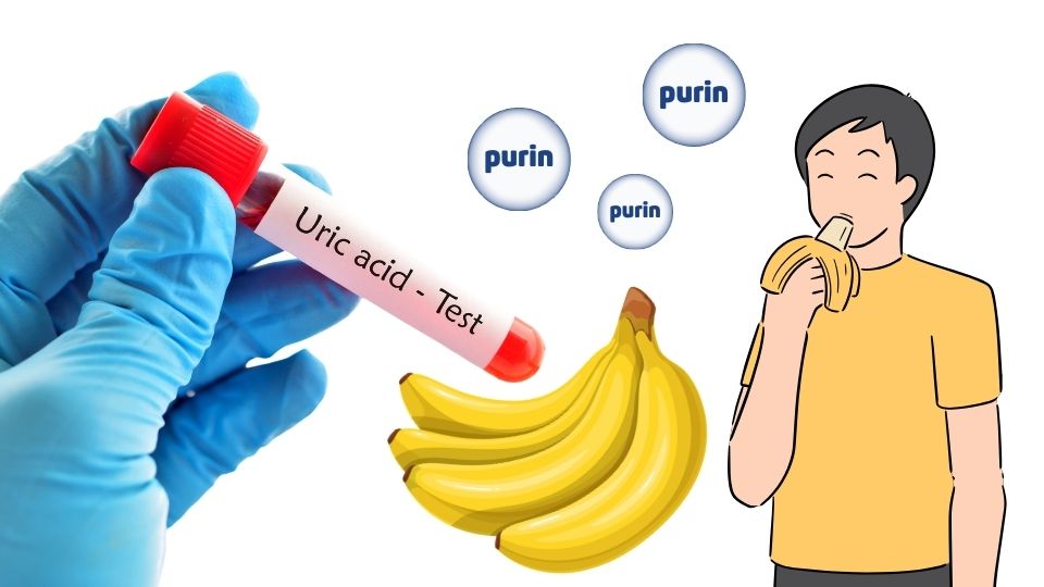 Ăn bao nhiêu chuối một ngày để kiểm soát axit uric?