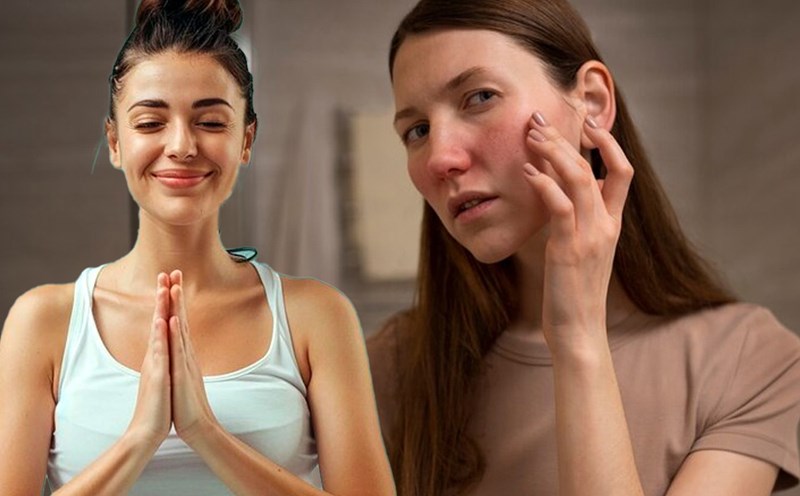 Yoga có tác dụng gì trong việc cải thiện sức khỏe làn da?