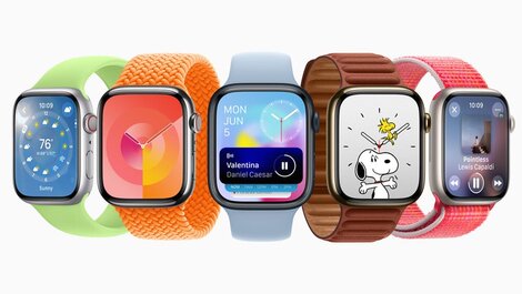 Apple Watch Series 10 sắp ra mắt sẽ có nhiều cải tiến khác biệt. Ảnh: Apple