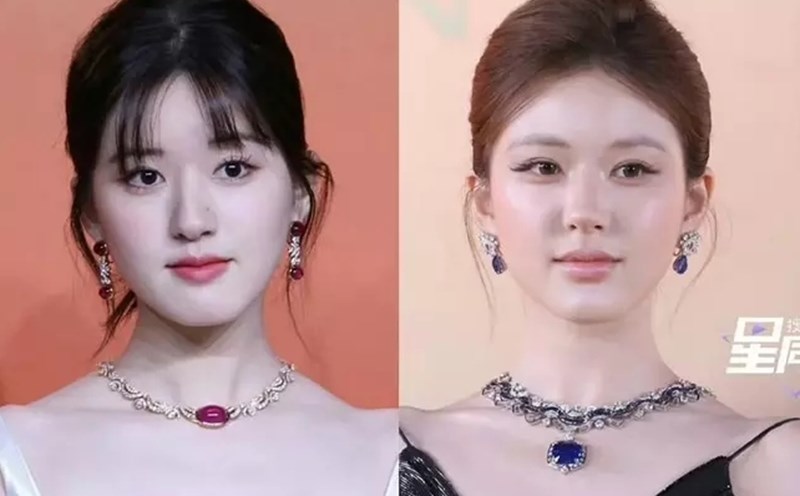 Triệu Lộ Tư bị nghi thẩm mỹ. Ảnh: CMH.