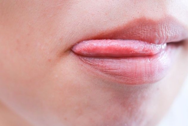 Liếm môi là thói quen không tốt mà các chị em cần phải bỏ. Ảnh: Pixabay