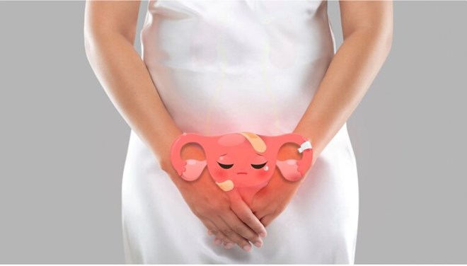 4 cách tự nhiên giúp giảm thiểu nóng rát vùng kín