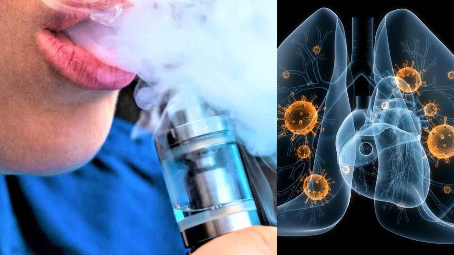 Ban on e-cigarettes, young people support for public health. Photo: Cao Thom