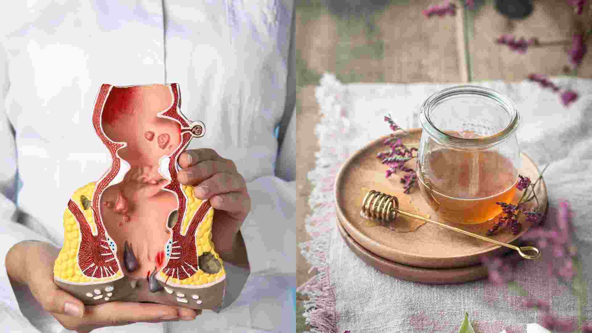 Honey water helps reduce hemorrhoids. Graphics: Ha May