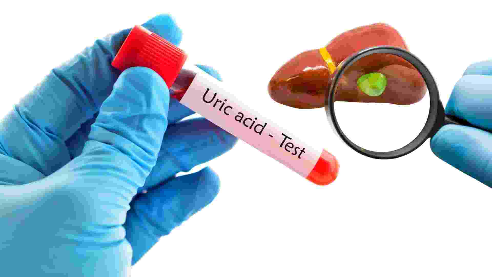 High uric acid affects the gallbladder, liver and kidneys. Graphics: Ha May