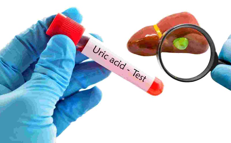 High uric acid affects the gallbladder, liver and kidneys. Graphics: Ha May