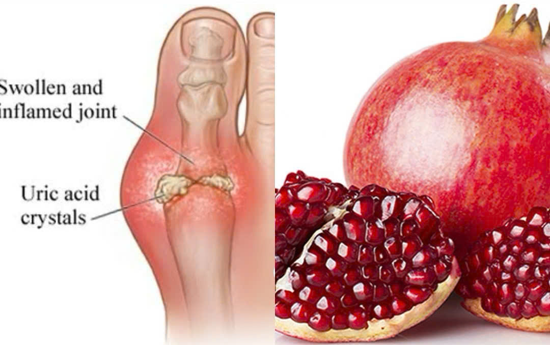 Benefits of pomegranate in reducing uric acid. Graphics: Huong Giang