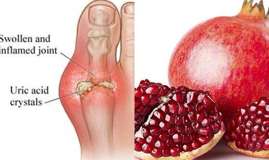 Lợi ích của quả lựu trong việc giảm axit uric. Đồ họa: Hương Giang