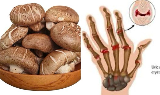 Cách ăn nấm đông cô hiệu quả để tránh tăng axit uric. Đồ họa: Hương Giang