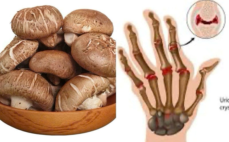 How to eat shiitake mushrooms effectively to avoid increasing uric acid. Graphics: Huong Giang
