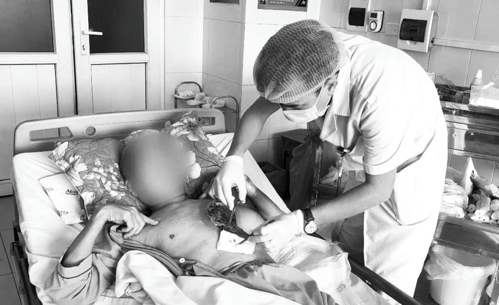 Doctor examines rare fungal case causing chest necrosis. Photo: Thanh Dang