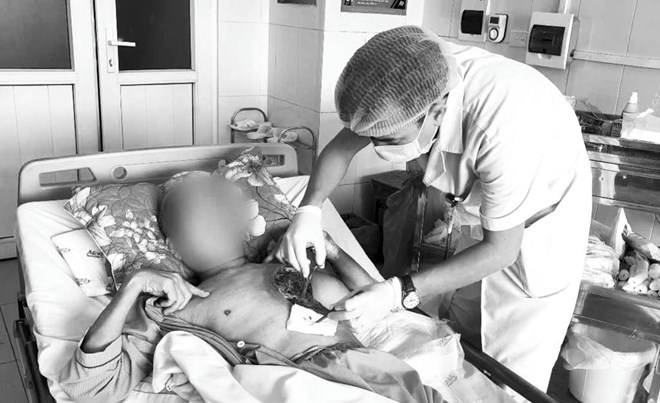 Mắc nấm hiếm gặp, người đàn ông hoại tử vùng ngực