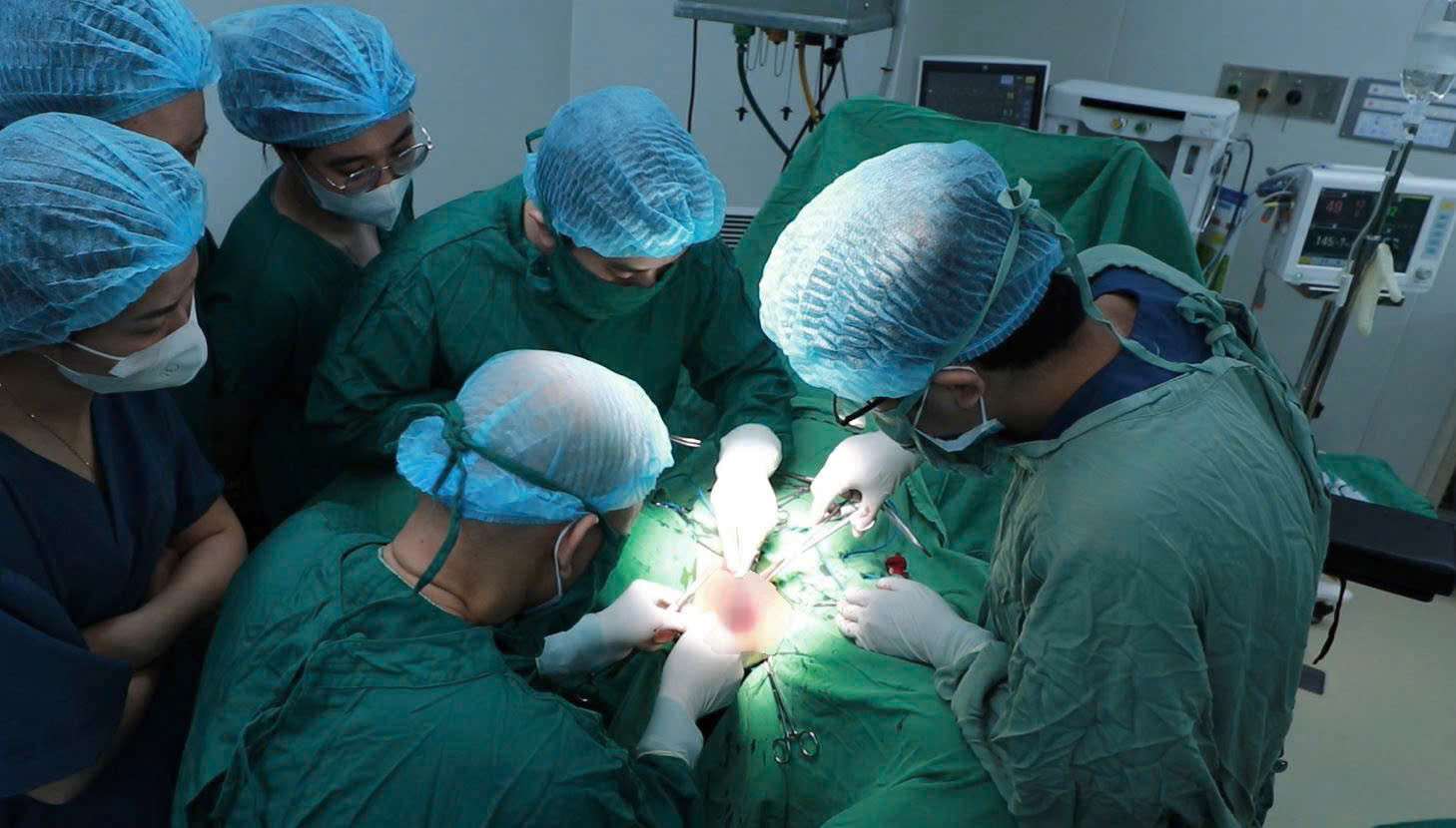 Các bác sĩ phẫu thuật cắt bỏ khối u khổng lồ cho người bệnh. Ảnh: BVCC