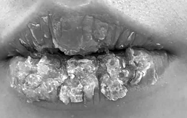 Note the complications when tattooing lips. Photo: BVCC