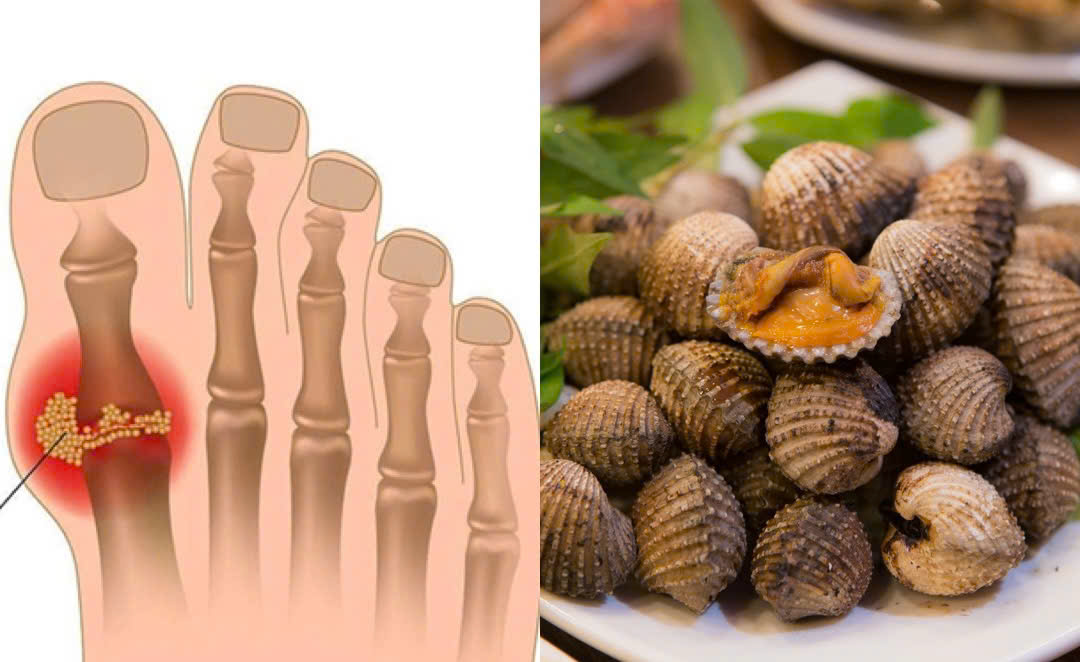 Blood cockles increase uric acid. Graphics: Huong Giang