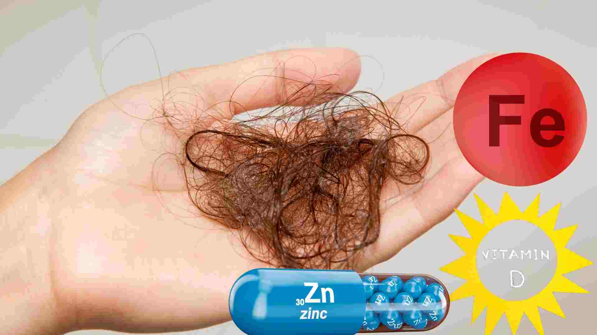 Vitamin deficiencies can cause hair loss. Graphics: Ha May