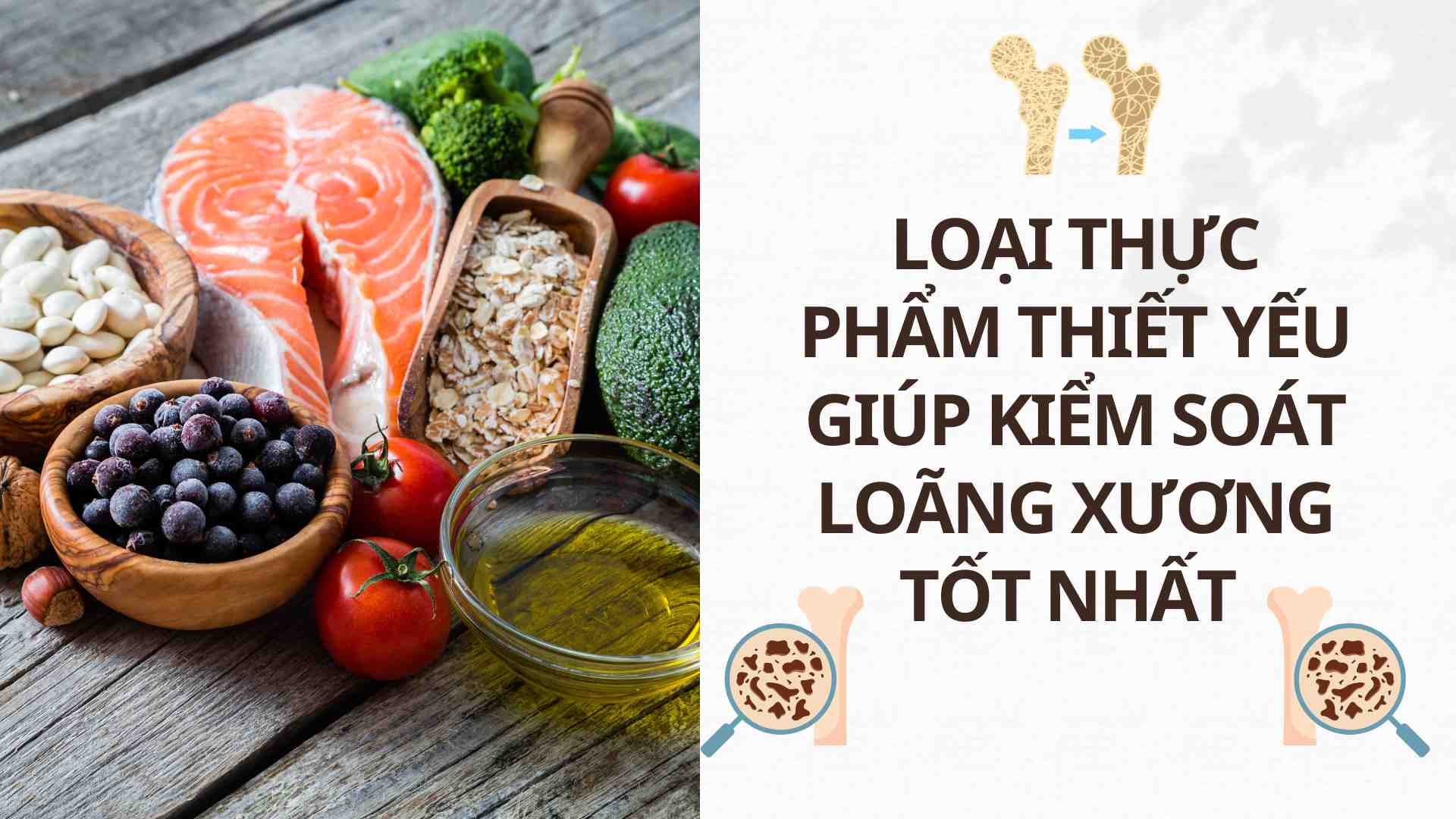 Essential foods that help control osteoporosis best. Photo: Cao Thom