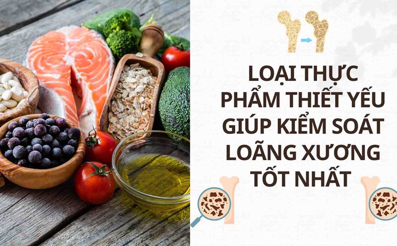 Essential foods that help control osteoporosis best. Photo: Cao Thom