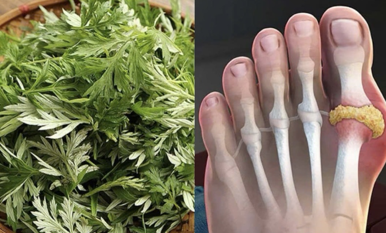 Natural solutions can help reduce uric acid. Graphics: Huong Giang