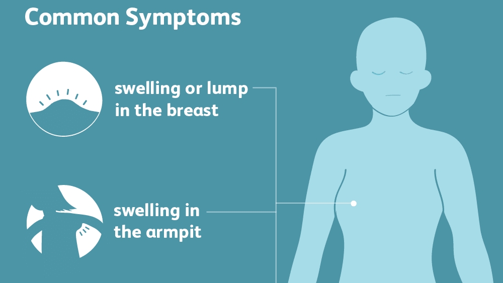 Breast cancer is common in women over 55 years old. Photo: Verywell Healthy