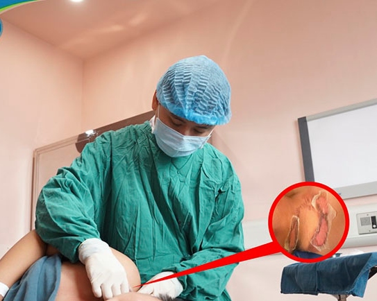 Children are treated for injuries caused by domestic accidents at the Orthopedics Department, National Children's Hospital. Photo: BVCC