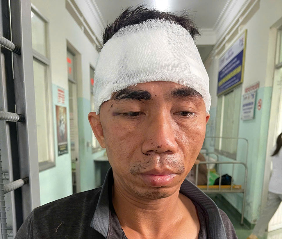 Công an huyện Tuy Phước (Bình Định) đã khởi tố, bắt tạm giam Trần Quốc Việt về hành vi Cướp tài sản. Ảnh: Công an