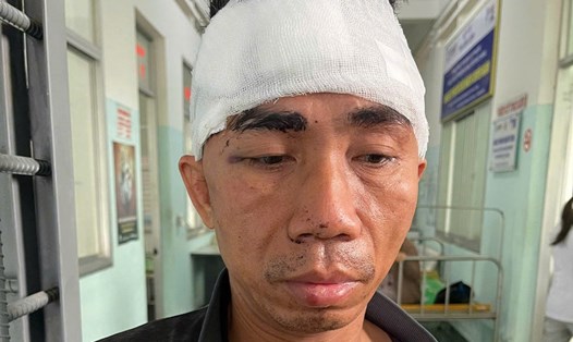 Công an huyện Tuy Phước (Bình Định) đã khởi tố, bắt tạm giam Trần Quốc Việt về hành vi Cướp tài sản. Ảnh: Công an