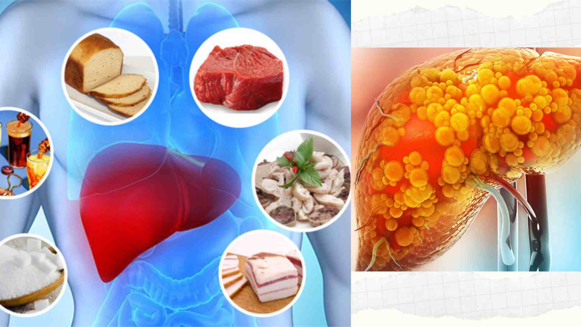 Foods to avoid during Tet for people with fatty liver. Graphics: Hoang Khoi