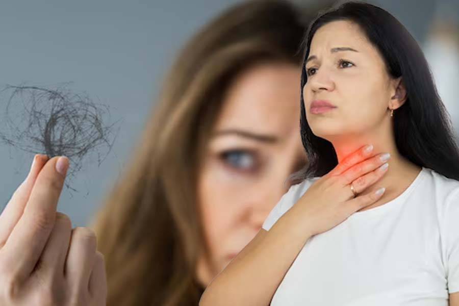 Hair loss can be an early sign of a thyroid disorder, especially when accompanied by other symptoms such as fatigue and weight changes. Graphics: Thien Nhan