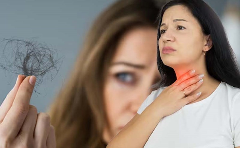 Hair loss can be an early sign of a thyroid disorder, especially when accompanied by other symptoms such as fatigue and weight changes. Graphics: Thien Nhan
