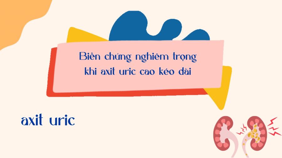 Serious complications when uric acid is high for a long time. Graphics: Phuong Anh