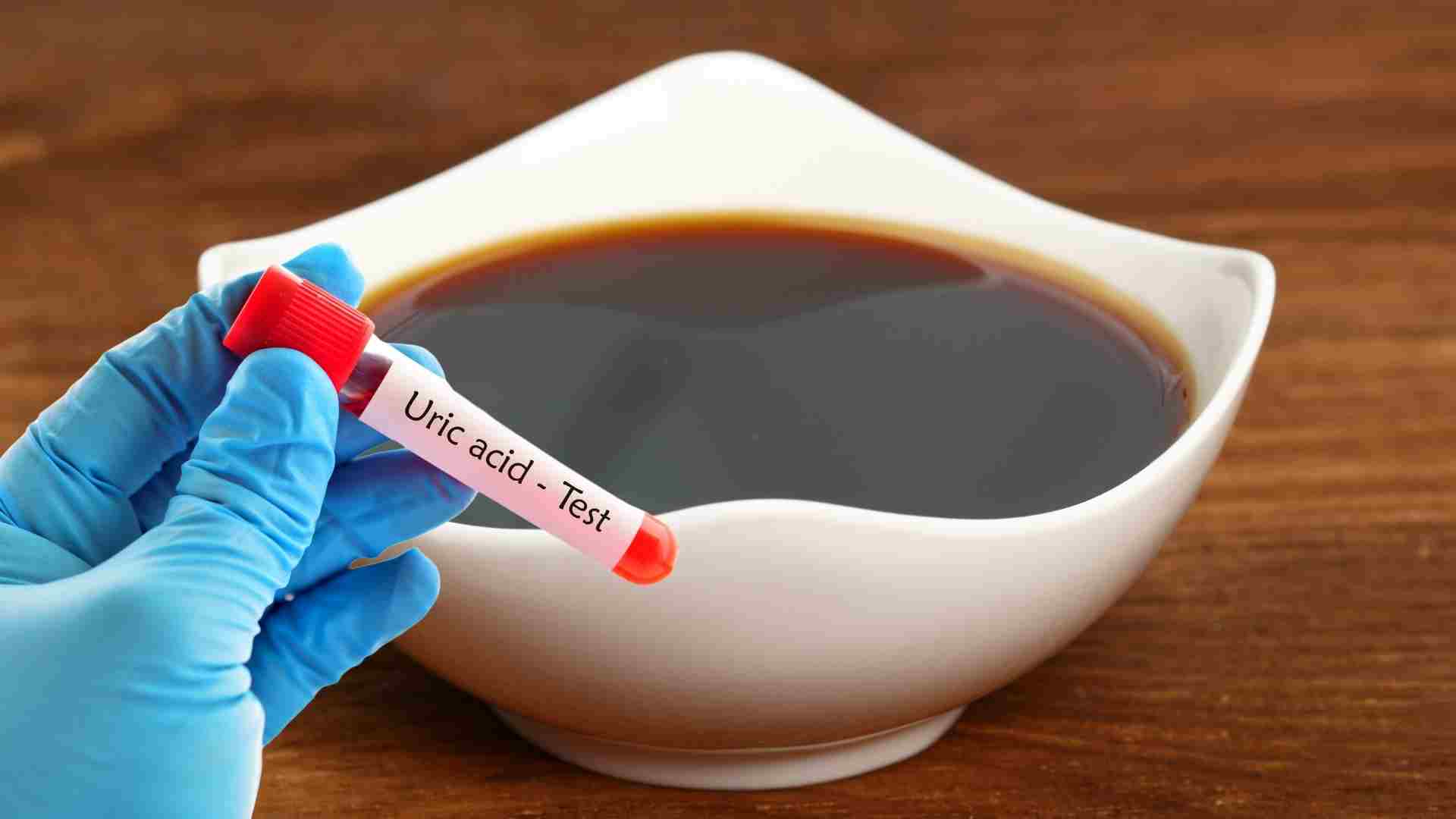 Soy sauce has a high sodium content which increases uric acid. Graphics: Ha May