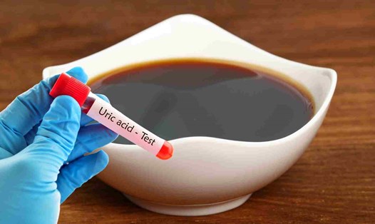 Nước tương có hàm lượng natri cao gây tăng axit uric. Đồ họa: Hạ Mây