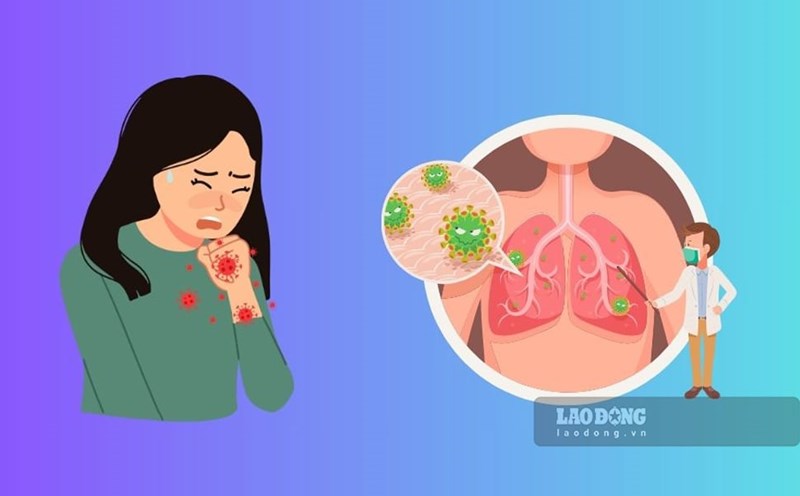 In 2024, Binh Dinh recorded 16 cases positive for influenza A/H1pdm, including 4 deaths. Graphics: Phuong Thao